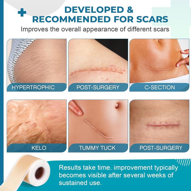 Professional Silicone Scar sheets