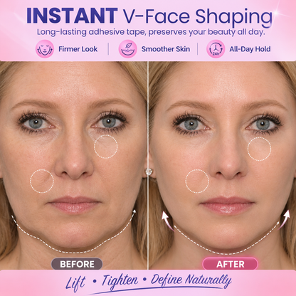 Cinta Adhesiva Invisible Lifting V-Face👑